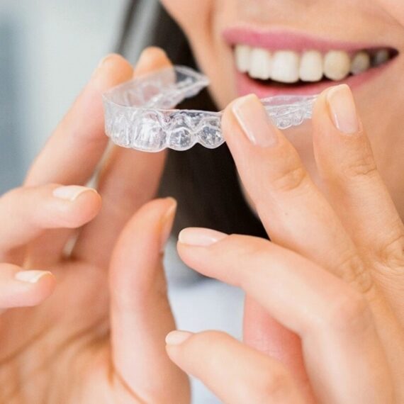 Invisalign-in-New-York