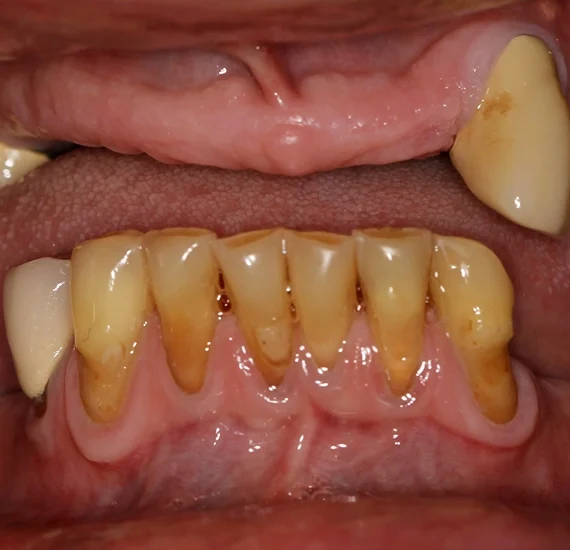 General Dentistry in New York