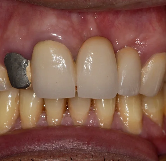 Orthodontics in East Village
